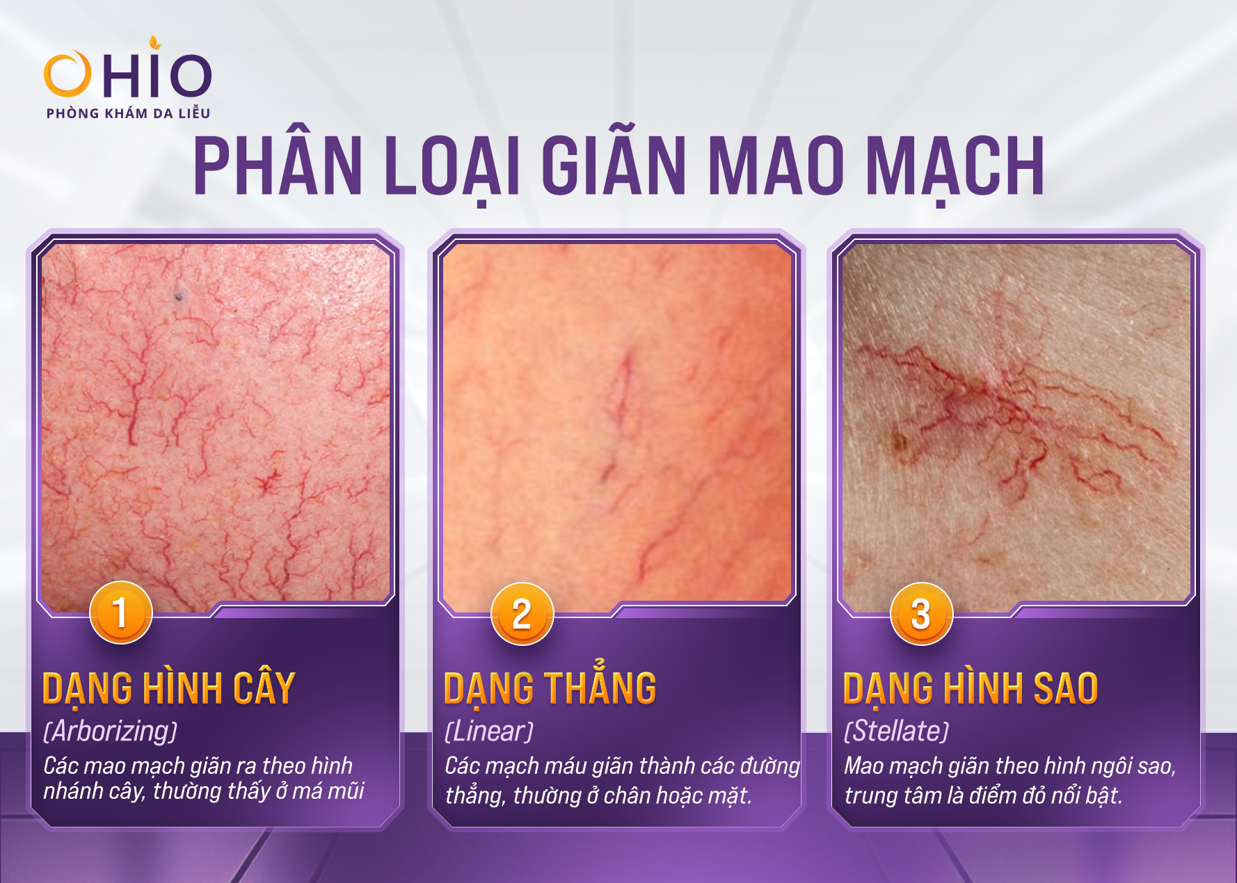 1707-web-minhanh-02-1755337734.png