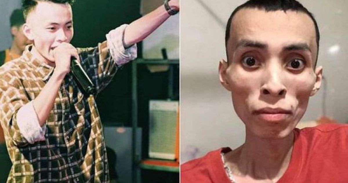 Nume Rapper Nam rapper qua đời vì ung thư ở tuổi 27, bác sĩ chỉ cách phòng tránh ...