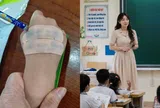 Con tiểu học đi thi, mẹ Việt lấy băng y tế dán đầy tay bé, cô giáo phát hiện dòng chữ xúc động nhắn nhóm lớp