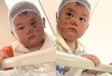 Bé trai 3 tuổi mặt đầy vết thương túc trực chăm mẹ nằm giường bệnh, câu chuyện phía sau ai nghe cũng nghẹn lòng