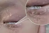 Bé 3 tuổi nhỏ keo 502 vào mắt, bố bình tĩnh cứu nguy trong 60 giây khiến bác sĩ cũng nể phục