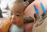 Con đi chơi bị ong đốt khiến môi sưng vù, người mẹ cứu sống con trong 20 phút, bác sĩ khen: Giỏi lắm!
