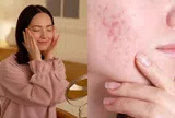 Tưởng chăm da kỹ, ai ngờ 5 thói quen này lại khiến lỗ chân lông nở to, da xuống cấp nhanh chóng
