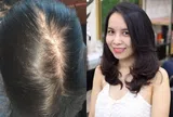 Không cần thuốc đắt tiền, phụ nữ U40 vẫn có thể sở hữu mái tóc dày khỏe nhờ 5 thay đổi trong sinh hoạt