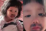 Ngủ dậy thấy miệng mọc vết bầm đen, bé gái khóc thét, mẹ phát hiện nguyên nhân từ món con ăn mỗi ngày