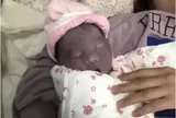 Con vừa chào đời đã có làn da tím khác thường, bố mẹ lo lắng, nào ngờ 2 tháng sau nhận không ra con