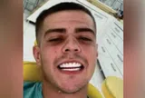 Bức ảnh selfie lột sạch lớp mặt nạ hoàn hảo của "trùm ma túy" 23 tuổi