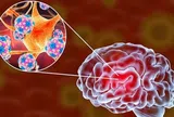 4 loại virus nguy hiểm bùng phát mùa hè đừng nhầm lẫn là cúm: Có 1 dấu hiệu xuất hiện phải nhập viện ngay