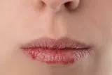 Muốn có một đôi môi hồng hào, căng mọng bạn hãy dừng lại ngay những thói quen này