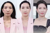 Bich Nguyet Beauty Medical - Địa chỉ dẫn đầu trẻ hóa tại miền Bắc với công nghệ PicoGen AI