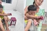 Tai nạn thương tâm: Điện thoại nghi phát nổ, bé trai 9 tuổi bị dập bàn tay phải
