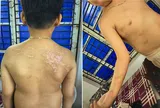 Khởi tố người cha đánh con ruột gây thương tích 36% ở Phú Thọ