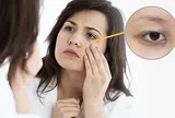 5 thực phẩm có thể hỗ trợ cải thiện quầng thâm mắt