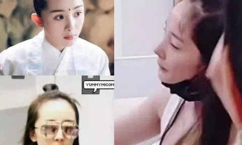 Là tiểu hoa đắt giá nhất showbiz nhưng Dương Mịch lại khổ sở mỗi khi nhìn lên trán