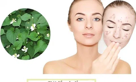 12 Cách làm mặt nạ diếp cá giúp trị mụn, nám hiệu quả tại nhà