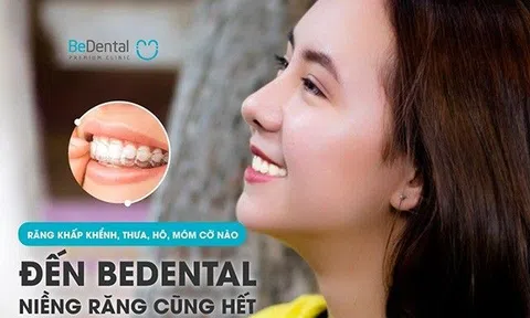 Nha khoa Thẩm mỹ Bedental - Địa chỉ niềng răng trả góp uy tín thủ tục đơn giản
