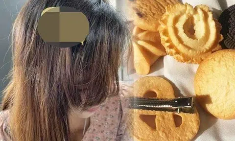 Những chiếc kẹp tóc hot nhất ngày hôm nay: món nhìn xinh xắn, món chỉ muốn “bịt mũi”