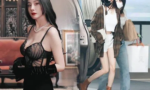 Dương Mịch tái xuất với một mắt băng kín, đôi chân gầy nhom gây tranh cãi