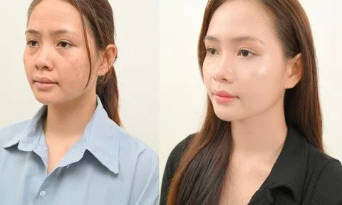 Da căng bóng sáng mịn với liệu trình GS SKIN tại PAN Beauty