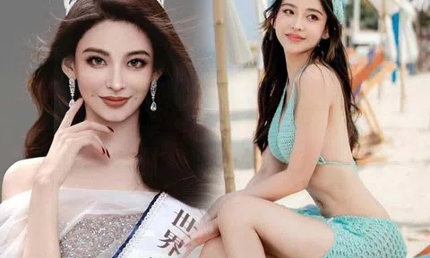 Hot girl chứng khoán thích diện váy ngắn bị phản đối khi được tham gia Hoa hậu Thế giới