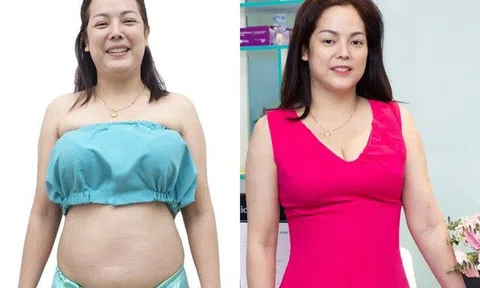 Hành trình U45 thay đổi vóc dáng nhờ hút mỡ Lipo PAL-Extra