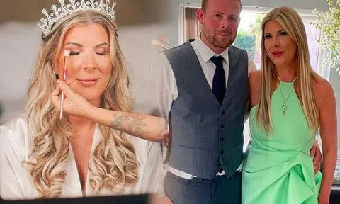 Cô dâu xinh đẹp phải hoãn đám cưới gấp vì tiêm filler hư đôi môi