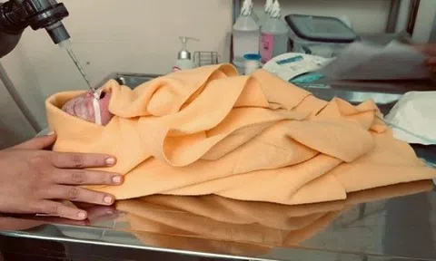 Mẹ bầu run rẩy lên bàn mổ khối u vẫn quyết giữ con và cái kết bất ngờ từ đôi tay kỳ diệu của bác sĩ