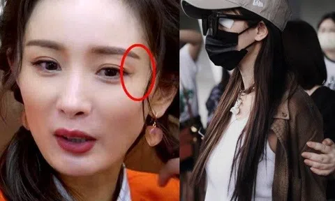 Dùng 700 triệu đồng để khâu khóe mắt, Dương Mịch vừa lộ mặt, fan nhìn đã giật mình