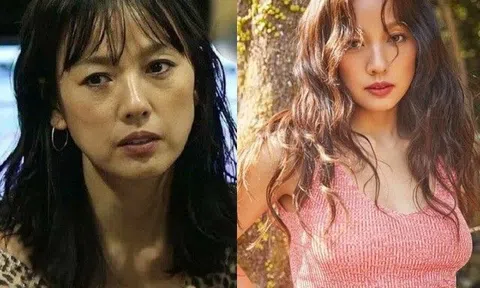 Từng là "nữ hoàng gợi cảm" của Kbiz, Lee Hyori giờ hốc hác, lão hóa nhìn đáng sợ