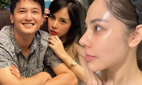 Bị nói thẩm mỹ như ma-nơ-canh, bạn gái hơn 6 tuổi của Huỳnh Anh treo thưởng 2000$ tìm bằng chứng