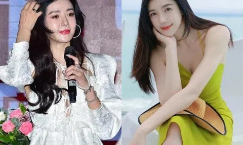 "Lợn lành chữa thành lợn què", sao nữ đang đẹp vì "sửa" quá nhiều mà giờ đau đớn