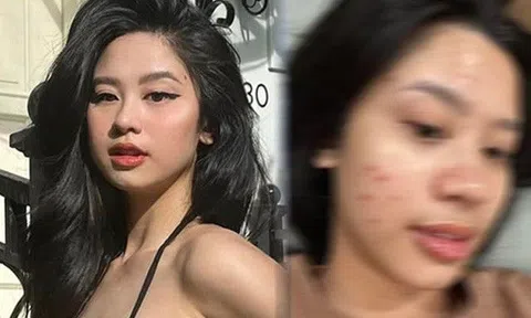 Hotgirl tạp hóa từng "vượt mặt" Nữ hoàng nội y về vóc dáng nay tự bóc ảnh mộc gây thất vọng
