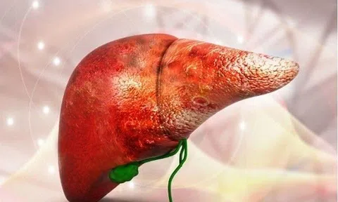 8 dấu hiệu cảnh báo “gan xấu”, hãy tránh những hành vi này hàng ngày để gan luôn khỏe mạnh
