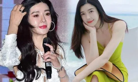 Chân dài đắt giá đẹp như tiên vẫn mê "dao kéo", giờ mặt sưng phù biến dạng, fans ruột nhận không ra