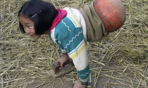 Cô bé từng bị tai nạn ô tô gây xót xa, diện mạo khi lớn xinh chuẩn mỹ nhân