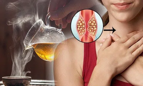 Uống loại trà này tăng nguy cơ mắc ung thư thực quản đến 90%, nếu làm thêm một điều càng nguy hơn