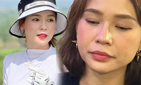 Từng bị hoa hậu tung ảnh dìm, hotgirl tài sản 50 tỷ giờ đi golf khư khư miếng dán trên mặt