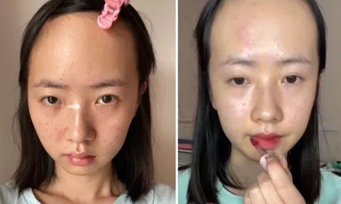 Cô gái mặt đầy mụn, "trán sân bay" học đòi makeup, tưởng quê mùa ai ngờ thành mỹ nhân!
