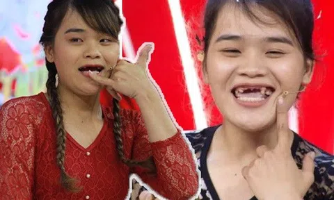 Hết trồng răng, "Thánh Sún" náo loạn Thách thức danh hài tiếp tục sửa sang, diện mạo ngày càng lạ