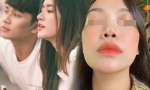 Đòi lấy sụn tai bạn trai nâng mũi, gái xinh làm cõi mạng lao đao, bác sĩ trả lời thế nào?