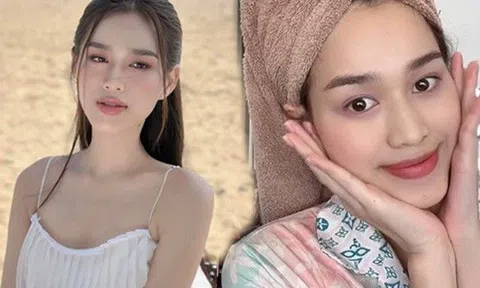 Uốn ép tóc hằng ngày nhưng dưỡng tóc mỗi lần chỉ 10K, "hoa hậu cấy lúa" chống hói thành công