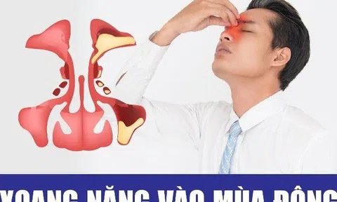 Chuyên gia cảnh báo viêm xoang tái phát mùa đông và cách khắc phục hiệu quả nhất