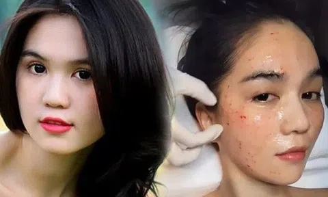 Từng tự tin có gương mặt mang "vẻ đẹp quê" trẻ lâu, Ngọc Trinh nay thừa nhận phải đi "chích nhẹ" khi cần