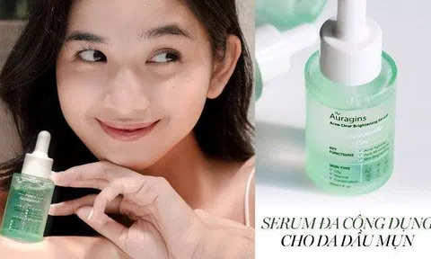 5 lý do cộng đồng làm đẹp gọi serum 10% Niacinamide của The Auragins là “chân ái” của làn da dầu mụn