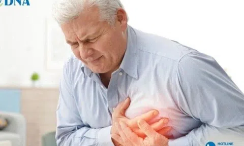 Lọc máu ngừa đột quỵ