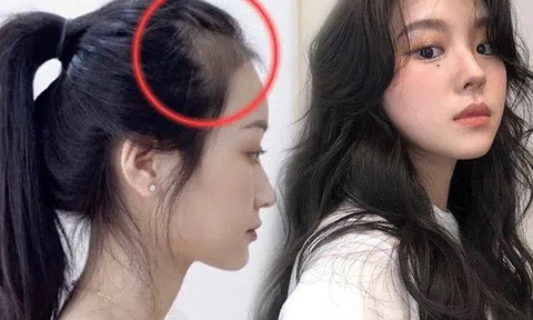 Sau khi gội đầu, đây là 3 thói quen làm tóc rụng triền miên mà hội chị em hói đầu hay mắc