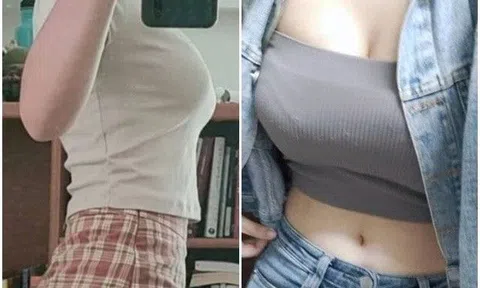 Cô gái thử 7 năm thả rông ra đường bất chấp mọi ánh nhìn nhận kết quả bất ngờ khi kiểm tra cặp tuyết lê