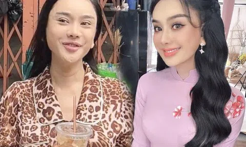 Lộ mặt mộc với cổ nhăn nheo, Lâm Khánh Chi bị chê "giống bà ngoại" dù mới bỏ 1 tỷ đồng tân trang