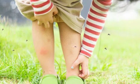 Mẹo xử lý côn trùng cắn, đốt cho gia đình khi về quê ăn Tết, du xuân