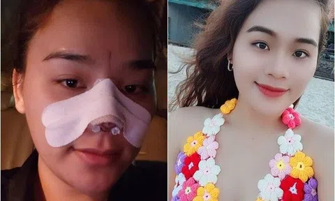 Cô gái mất 9 cái răng đổi đời sau khi "làm danh hài cười", giờ còn đổi cả diện mạo, bị nói giàu rồi khác